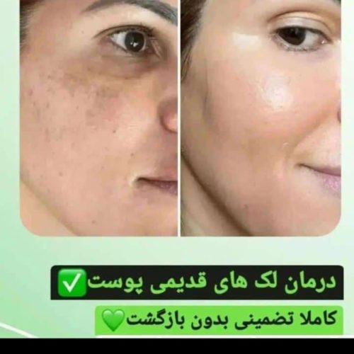 کرم عربی اماراتی