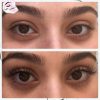 جشنواره تابستانه اکستنشن مژه لیفت و لمینت مژه و ابرو