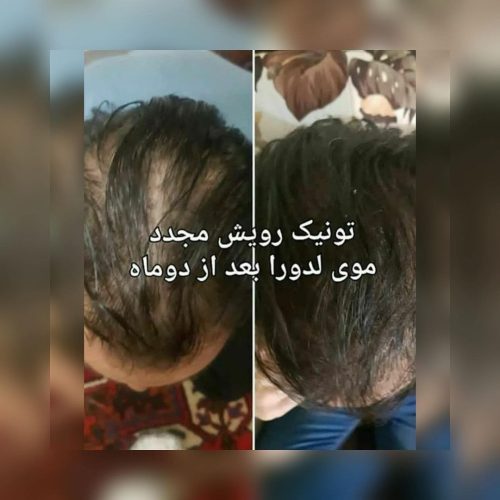 مشاور و نماینده محصولات لدورا