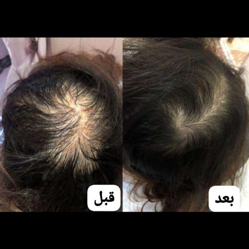 مشاور و نماینده محصولات لدورا