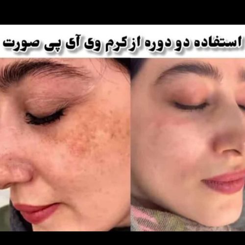 کرم عربی اماراتی