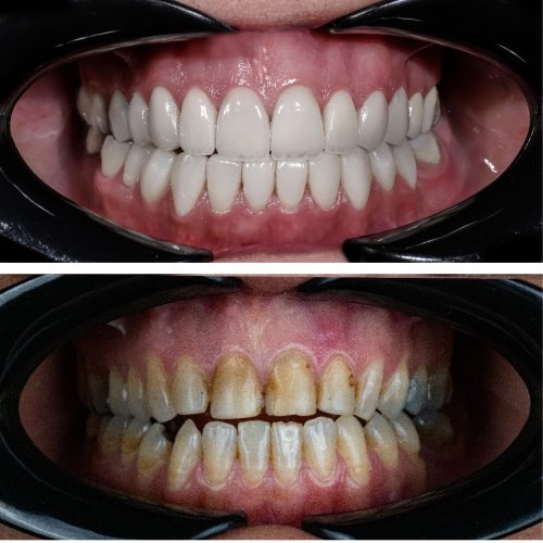 دندانپزشکی دکتر پاکدل، کلیه خدمات دندانپزشکی