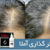 درمان قطعی ریزش مو و رویش مو