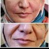 خدمات زیبایی آریشگاه فاطیما