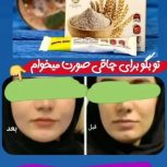 جوانه گندم  تپلی صورت