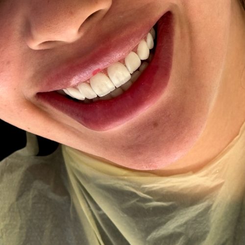 خدمات دندانپزشکی با تخفیف ویژه