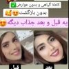 جوانه گندم  تپلی صورت