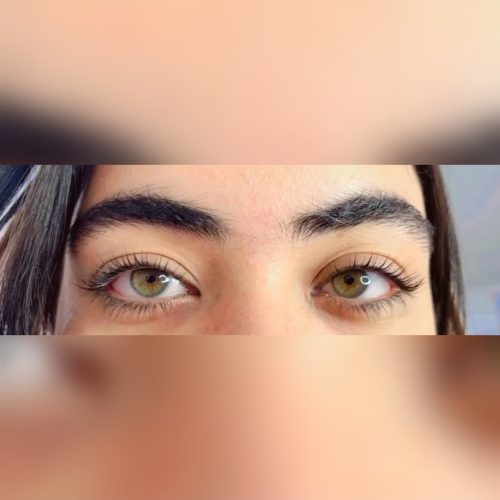 لیفت ابرو مژه