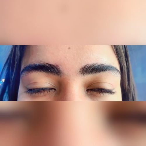 لیفت ابرو مژه