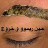 ریموو ابرو، فیبروز ابرو، اکستنشن مژه، لیفت لمینت مژه و ابرو