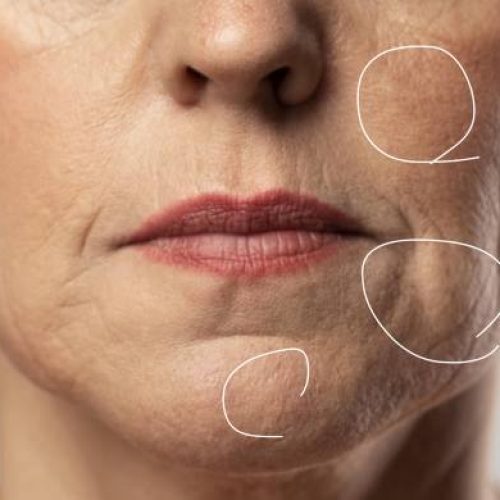 آموزش فیشیال