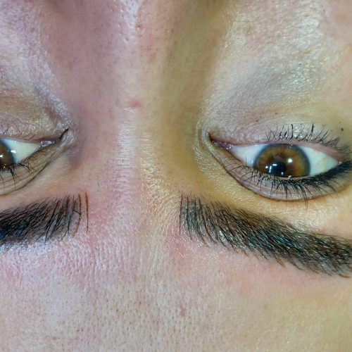 میکروبلیدینگ