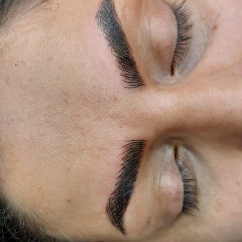 میکروبلیدینگ