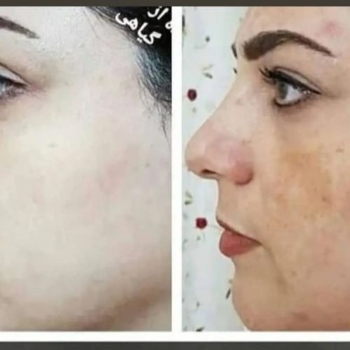 کرم روشن کننده پوست