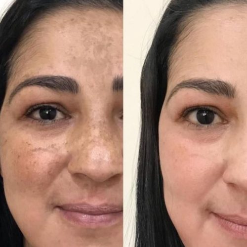 کرم اصل سفید کننده وضدلک