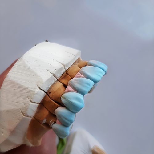 پرسلن گذار لابراتوار دندانسازی هستم ( آماده همکاری)