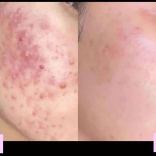 پکیج وایت رز