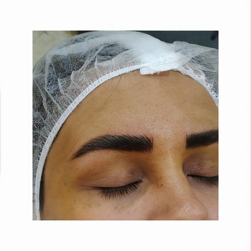 میکروبلیدینگ اَبرو