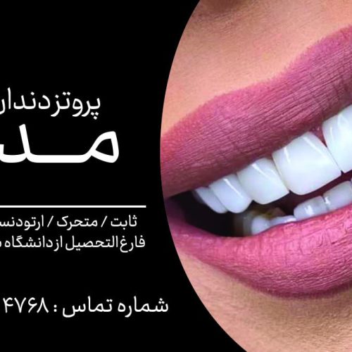 پروتز کار ثابت در لابراتوار دندانسازی