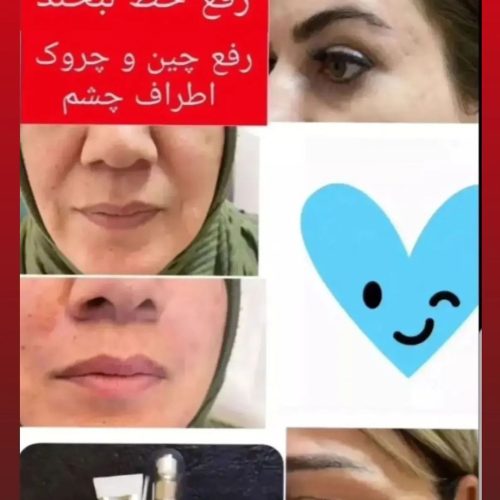آخرین سرم مخصوص چین و چروک صورت