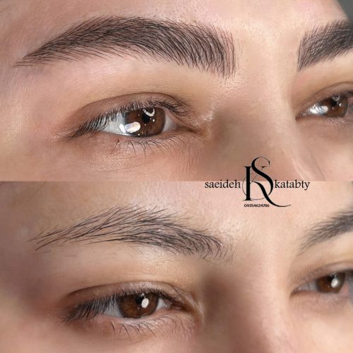 فیبروز ومیکرو بلیدینگ ابرو