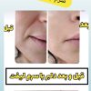 آخرین سرم مخصوص چین و چروک صورت