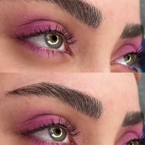 فیبروز ومیکرو بلیدینگ ابرو