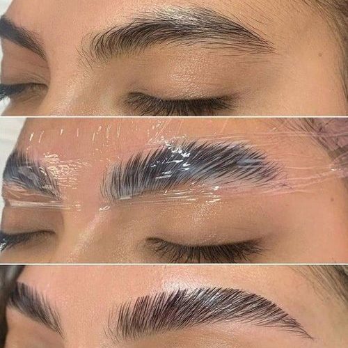 کاشت مژه بالیف مژه ابرو