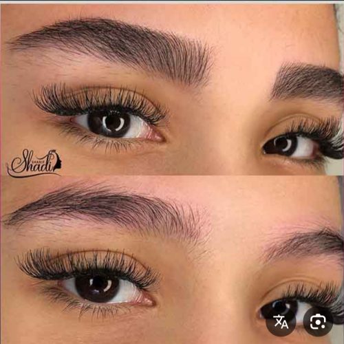 فیبروز میکرو بلیدینگ