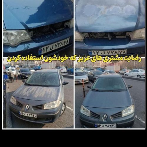 محصول رفع آفتاب سوختگی در منزل