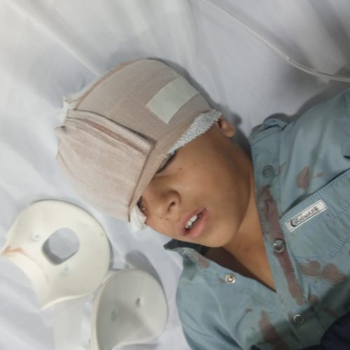 یهگونییهساکبالباسبلوچیدرتصادفدوراهیجیرفتبم