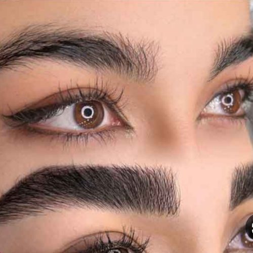 فیبروز میکرو بلیدینگ