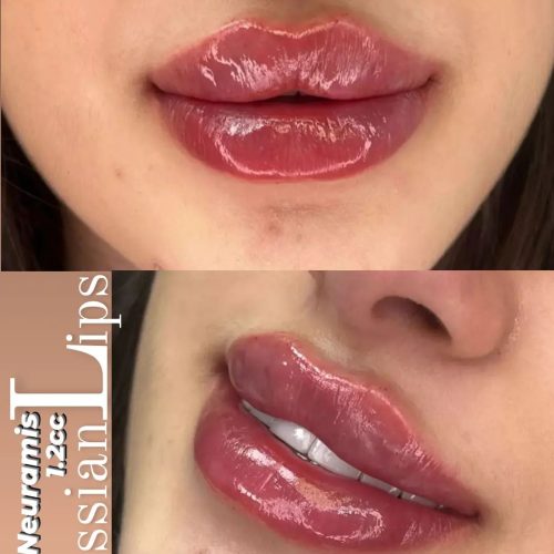 استخدام منشی مطب زیبایی(بلوار ابوذر یاسوج)