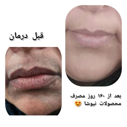 درمان و سلامت با طب سنتی