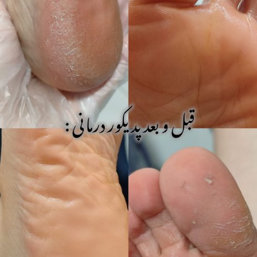 پدیکور تخصصی درمانی