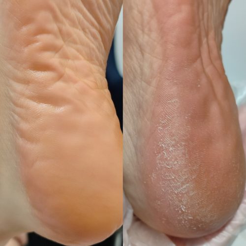 پدیکور تخصصی درمانی