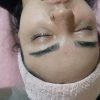 فشیال و پاکسازی پوست