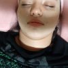 فشیال و پاکسازی پوست