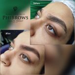 فراخوان خدمات میکروبلیدینگ