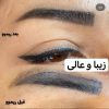 لیزر موهای زائد و خالبرداری