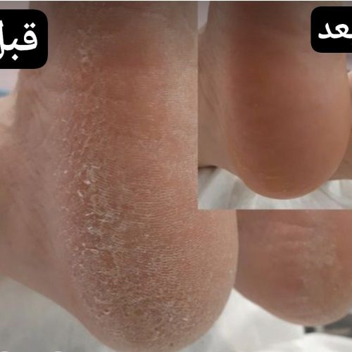 پدیکور و‌کفسابی