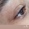 لیفت ابرو و مژه