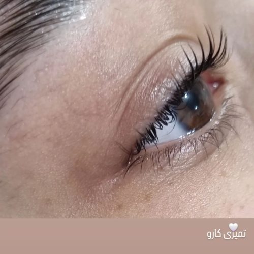 لیفت ابرو و مژه