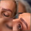 فراخوان خدمات میکروبلیدینگ