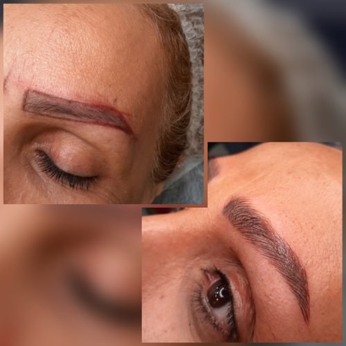 فراخوان خدمات میکروبلیدینگ