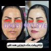 کرمvipاصل
