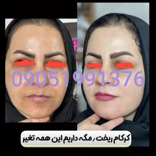 کرمvipاصل