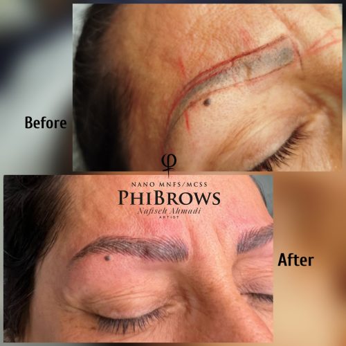فراخوان خدمات میکروبلیدینگ