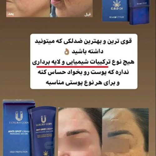 کرم ضد لک 8کاره لاچری کویین اصل