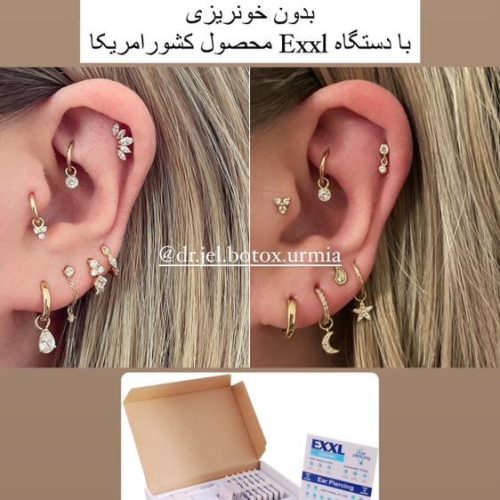 خدمات زیبایی تزریق ژل بوتاکس نخ